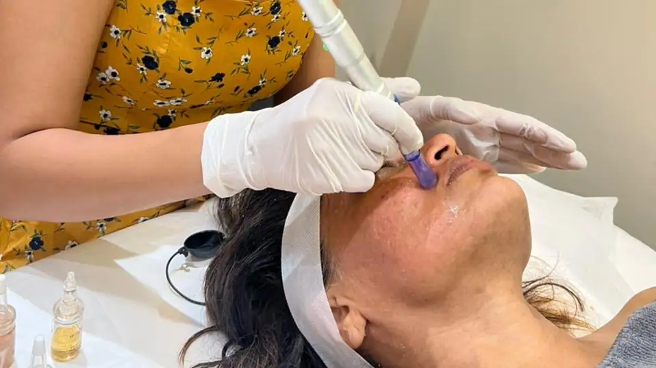 Hydra facial
