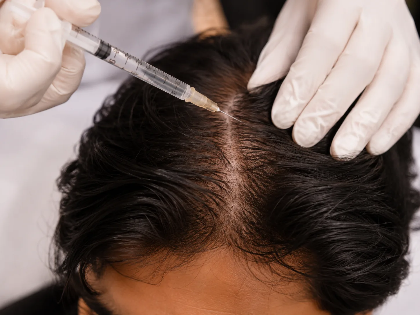 Korean hair fall and scalp treatment in Andheri West Mumbai