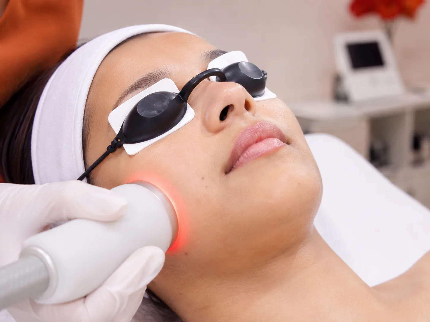 IPL photofacial light treatment for pigmentation at a skin clinic in Andheri West Mumbai