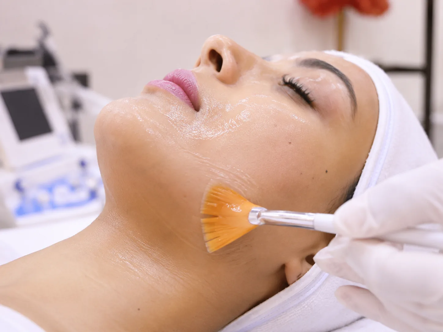 Troipeel Korean peel treatment for acne, pores and pigmentation in Andheri West Mumbai